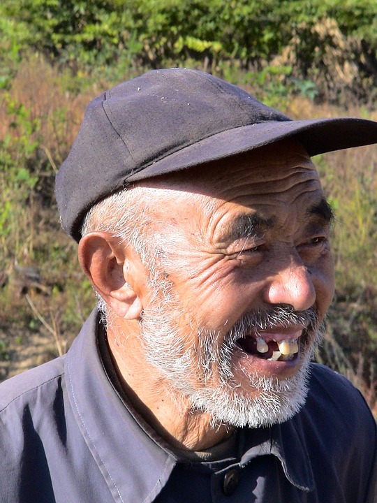 man with missing teeth