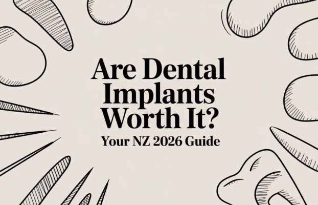 Are Dental Implants Worth It? Your NZ 2026 Guide